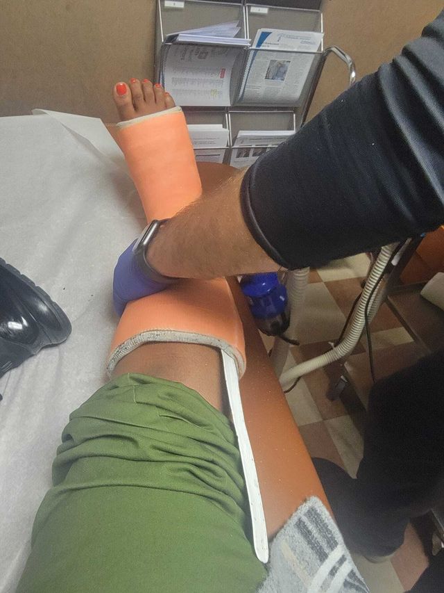 Photos of Tamila Glaze’s ankle injury, courtesy of Glaze. The former behavioral health associate at Metropolitan said she injured it while running away from a patient after breaking up a fight at the hospital on Mother’s Day 2019.